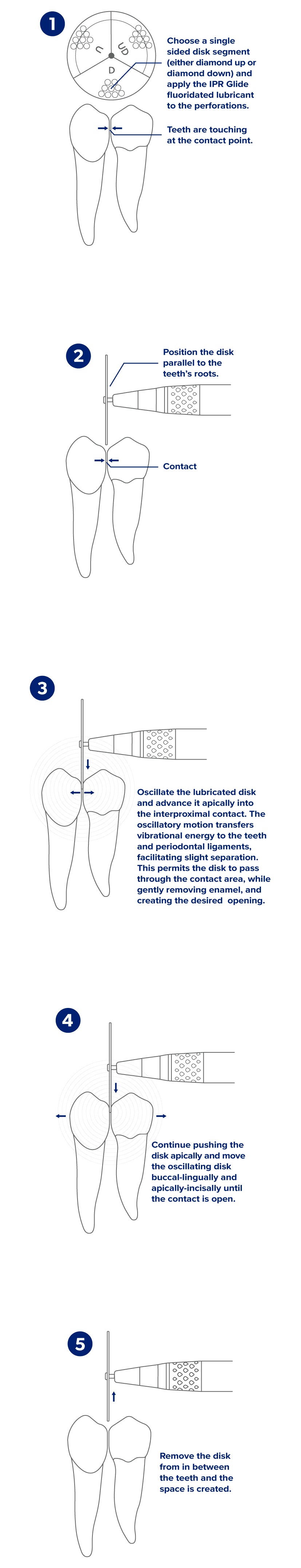 Step-by-step drawing showing how to use smartIPR