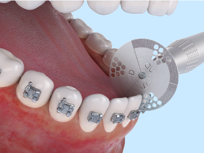 Real-time Tracking Feature