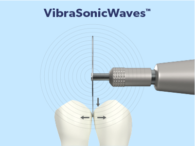 Smart Technology Feature